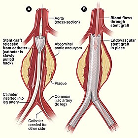 Minimally Invasive