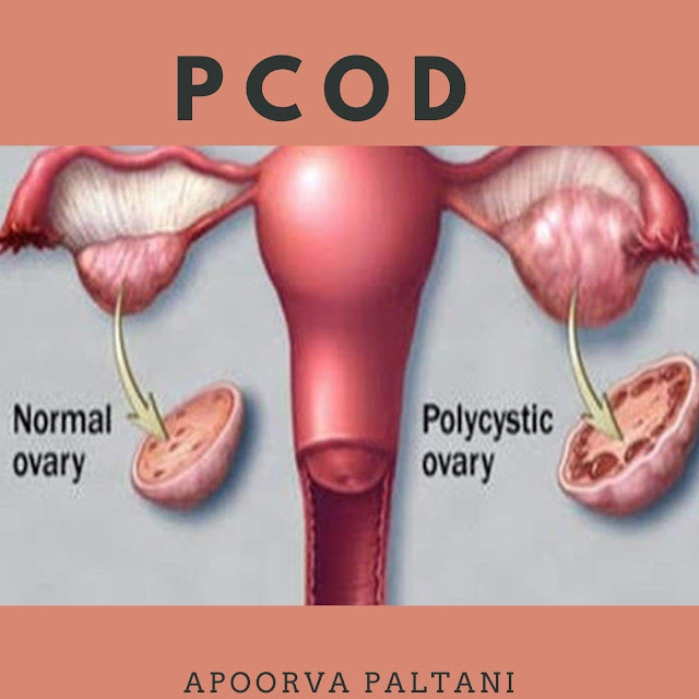 Pcod And Pcos Causes Symptoms Differences And Treatment Dr Nithiyaa